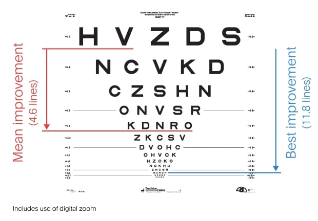 Researchers create brain implant that enables blind people to read again 69995